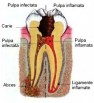 Interventie endodontica sector 6