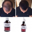 Set-L-Recapin-1+1-prevenirea-căderii-părului-şi-regenerare